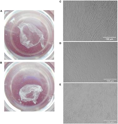 Mesenchymal Stromal Cell-Produced Components of Extracellular Matrix Potentiate Multipotent Stem Cell Response to Differentiation Stimuli